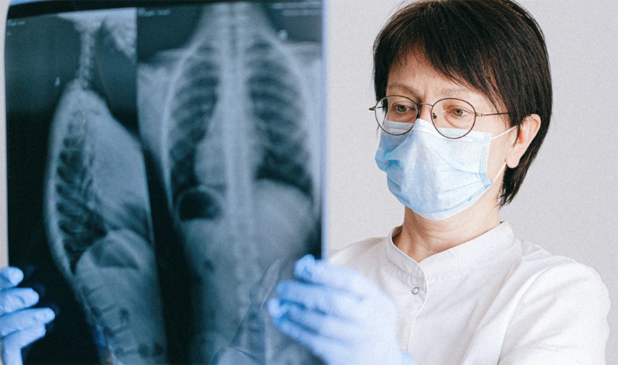 Noi tratamente pentru cancerul pulmonar 2022