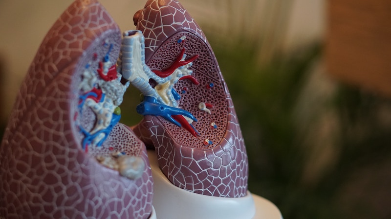 Fruquintinib ca tratament pentru cancerul pulmonar: Am ajuns deja acolo?